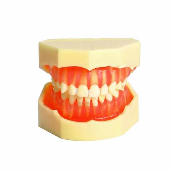 UM-7009 Modello di dentatura infantile rimovibile (20 denti rimovibili)
   