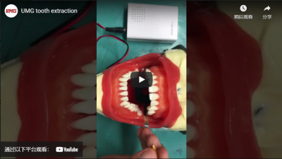 Estrazione del dente UMG
    robot