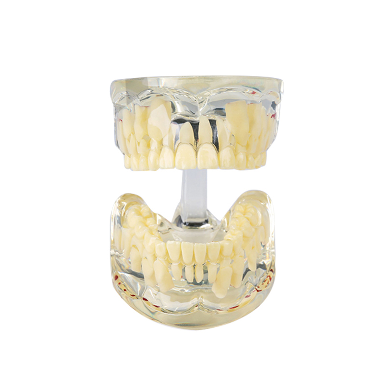 UM-7016 Modello trasparente per denti da latte
   （7 anni)
   