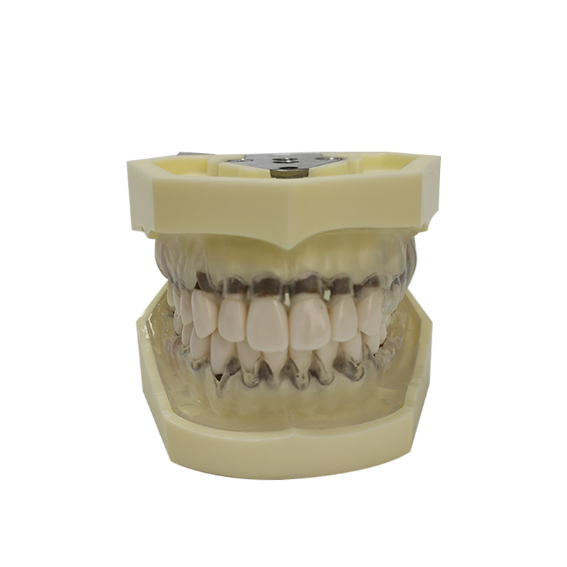 UM-4028 Periodontal Model with Transparent Gum
   