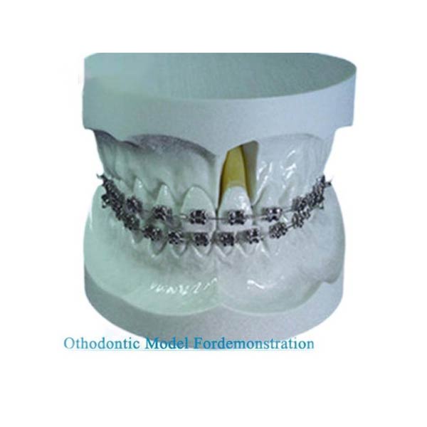 Modello ortodontico UM-S11 per la dimostrazione con staffa a montaggio