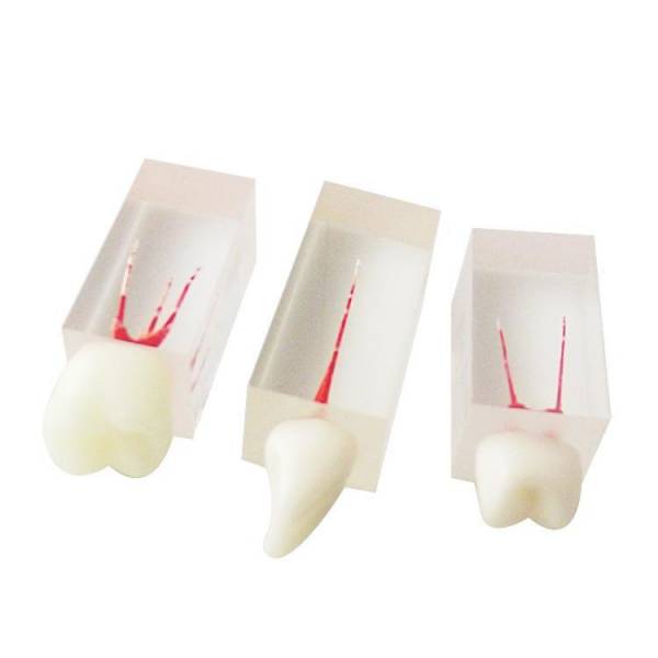 The Details of Um-ls7 Root Canal Model