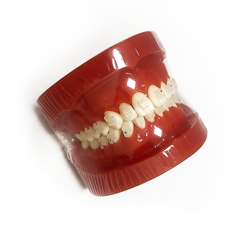 Modello ortodontico UM-B8 (staffe in ceramica)