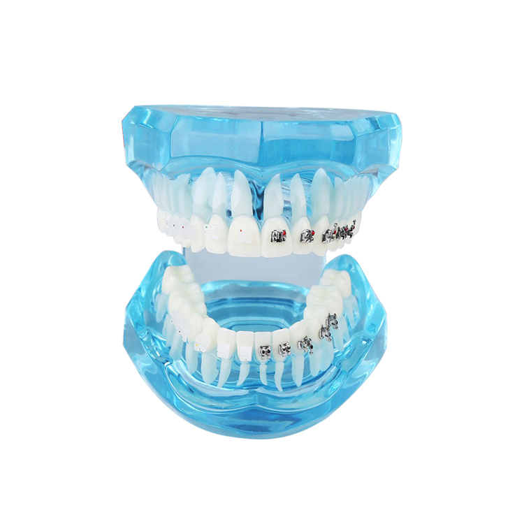 UM-B21 dentizione trasparente con le staffe