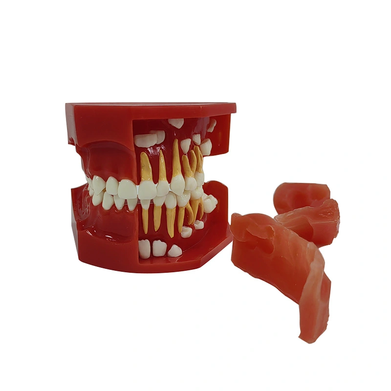 UM-S12A modello di sviluppo denturale A (3-6 anni)
